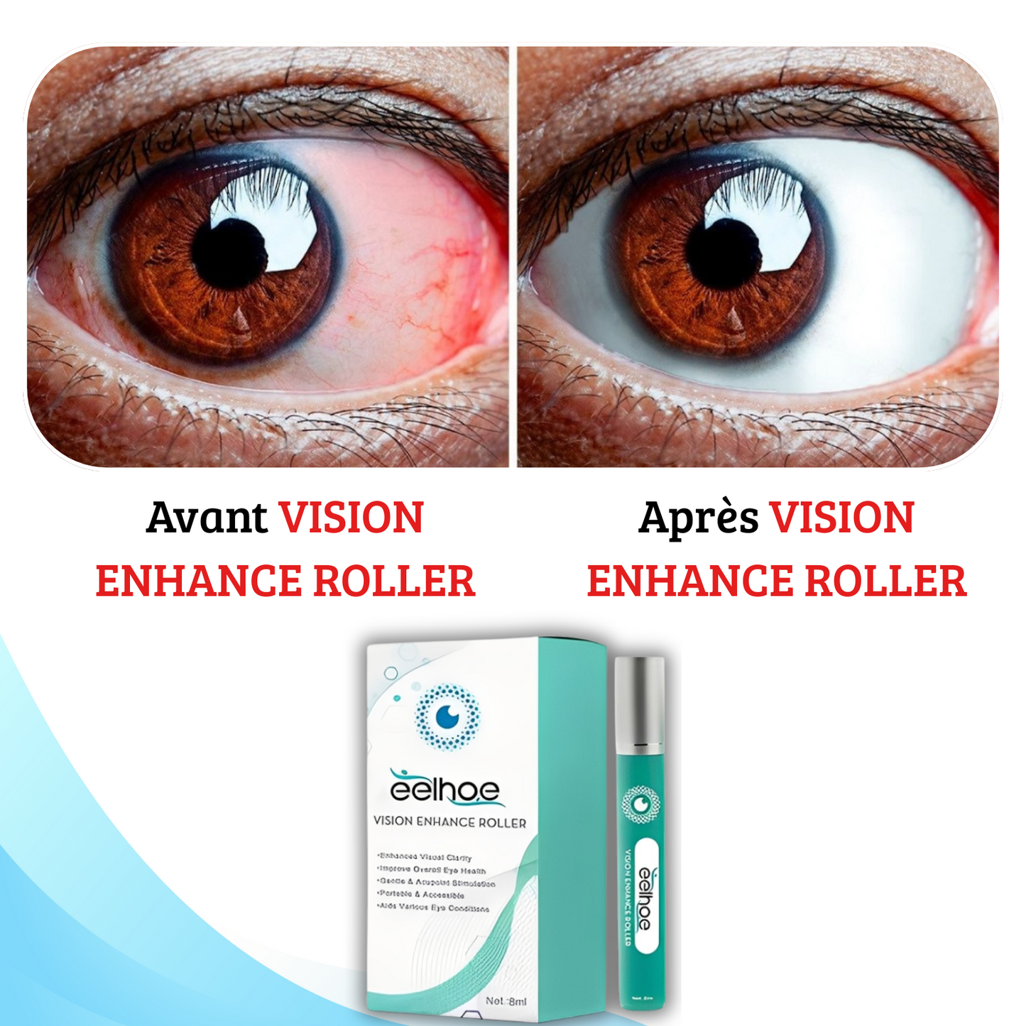 VISION  ROLLER : La clarté à Vos Yeux  Pour Toutes  Maladies Des  YEUX