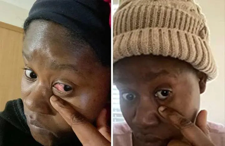 BOITE DE GOUTTES DE REPARATION OCCULAIRES POUR TRAITEMENT COMPLET : REPAIR CLEAR VISION